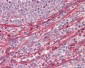 ADAM19 Antibody