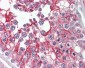 PIK3CG / PI3K Gamma Antibody