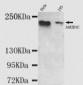 KDM5C / Jarid1C / SMCX Antibody (C-Terminus)