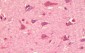 CHUK / IKKA / IKK Alpha Antibody (aa716-734)