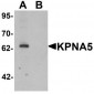 KPNA5 Antibody (N-Terminus)
