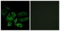 NT5C1A / CN1A Antibody (aa151-200)