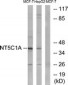 NT5C1A / CN1A Antibody (aa151-200)