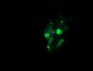 GLB1 / Beta-Galactosidase Antibody (clone 2F6)