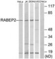 RABEP2 Antibody (aa353-402)