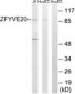 RBSN / Rabenosyn 5 Antibody (aa145-194)