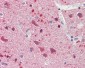 JMY Antibody (aa931-980)