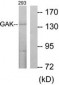 GAK Antibody (aa101-150)