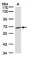 GGT1 / GGT Antibody (aa1-226)