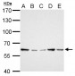 GGT1 / GGT Antibody (aa1-226)