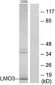 DAT1 / LMO3 Antibody (aa96-145)