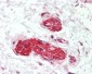 LMTK3 Antibody (aa1251-1300)
