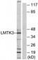 LMTK3 Antibody (aa1251-1300)