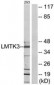 LMTK3 Antibody (aa1251-1300)