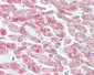 YTHDF1 Antibody (aa1-50)