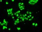 SSB / La Antibody (clone 1E11)