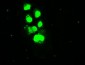 SSB / La Antibody (clone 1E11)