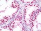 SSB / La Antibody (clone 1E11)