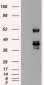 SSB / La Antibody (clone 1E11)