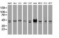 SSB / La Antibody (clone 1E11)