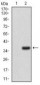 IL3RA / CD123 Antibody (aa200-305, clone 10B8E7)
