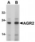 AGR2 Antibody (N-Terminus)