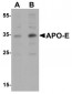 APOE / Apolipoprotein E Antibody (C-Terminus)
