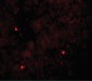 TRIM33 / TIF1-Gamma Antibody (Internal)