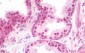 TRIM33 / TIF1-Gamma Antibody (Internal)