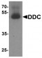 DDC / DOPA Decarboxylase Antibody (C-Terminus)