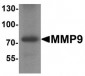MMP9 / Gelatinase B Antibody (Internal)