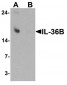 IL36B Antibody (C-Terminus)