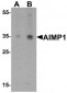 AIMP1 / EMAP II Antibody (C-Terminus)