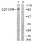 CD71 / Transferrin Receptor Antibody (aa15-64)