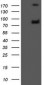 GLB1 / Beta-Galactosidase Antibody (clone 5H2)