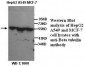 TUBB / Beta Tubulin Antibody