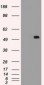 SERPINA1 / Alpha 1 Antitrypsin Antibody (clone 11G2)