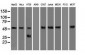 SERPINA1 / Alpha 1 Antitrypsin Antibody (clone 11G2)