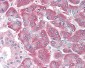 AIMP1 / EMAP II Antibody (aa137-149)
