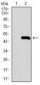 ALK3 / BMPR1A Antibody (aa179-378, clone 4B7B2)