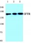 CFTR Antibody (Glu733)