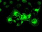 CRYAB / Alpha B Crystallin Antibody (clone 6D11)