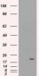 CRYAB / Alpha B Crystallin Antibody (clone 6D11)