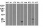 CRYAB / Alpha B Crystallin Antibody (clone 6D11)