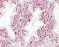 CTNNB1 / Beta Catenin Antibody (Internal)