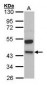 KNG1 / Kininogen / Bradykinin Antibody (aa1-416)