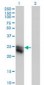 CTHRC1 Antibody (clone 1G12)