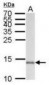 AIF1 / IBA1 Antibody (aa85-147)