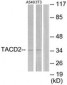 TROP2 / TACSTD2 Antibody (aa131-180)