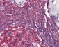 CD20 Antibody (C-Terminus)